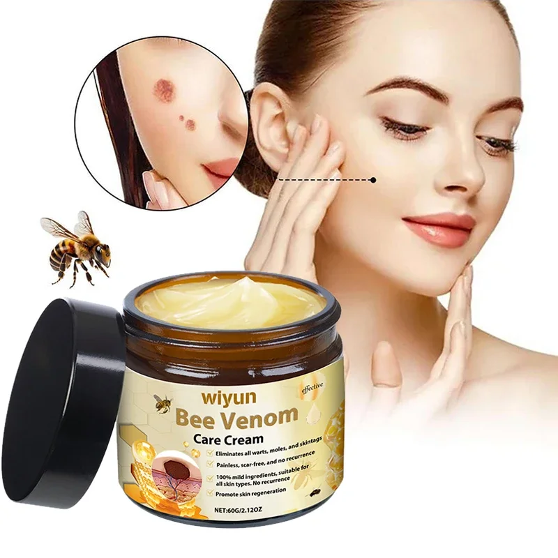 Bee Venom Skin Care Treatment Cream,Herbal Formula Soothing Nourishing Moisturizing Skin,Remove Scars And Spots Skin Savior