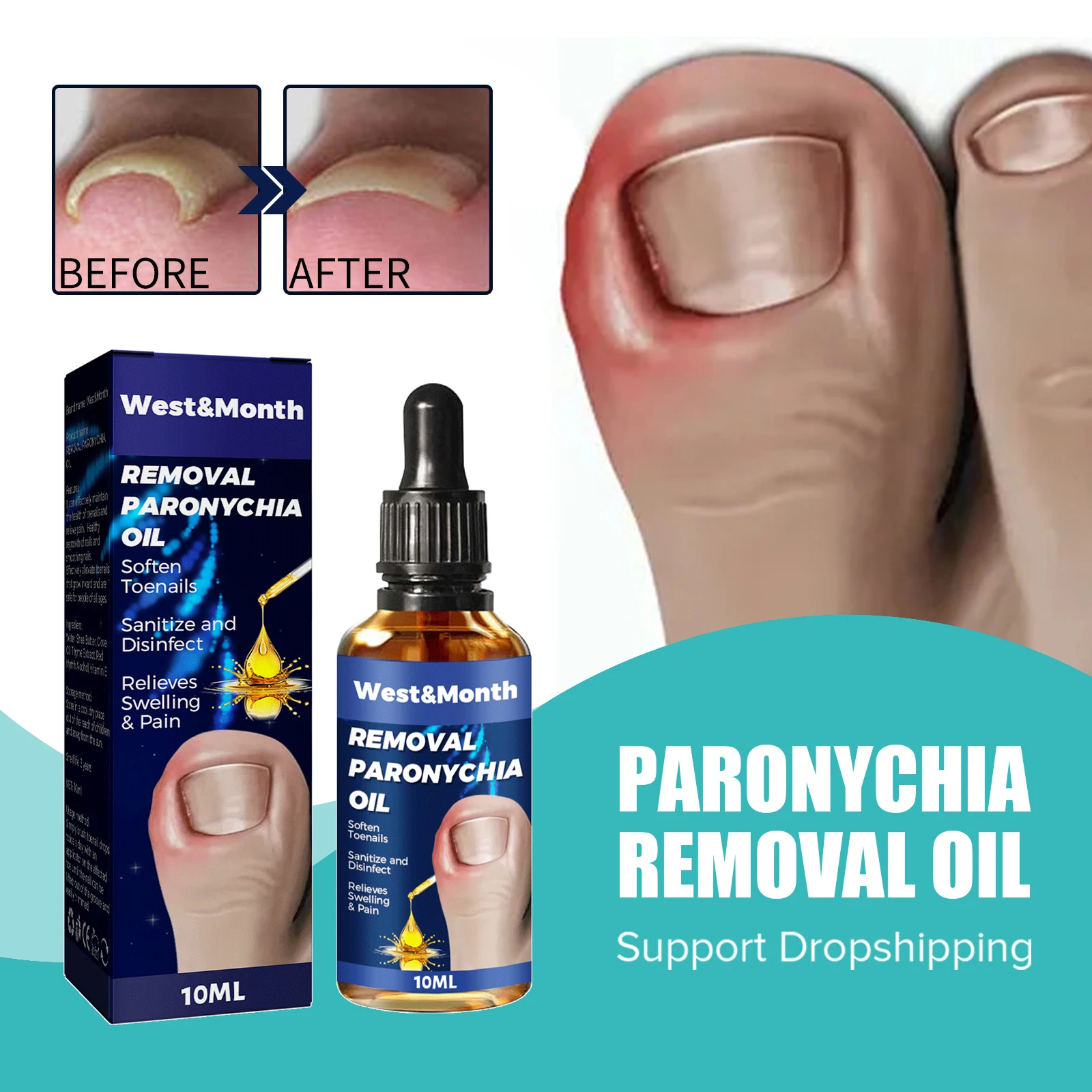 Ingegroeide Teennagels Reparatie Serum Drop Nail Correctie Herstellen