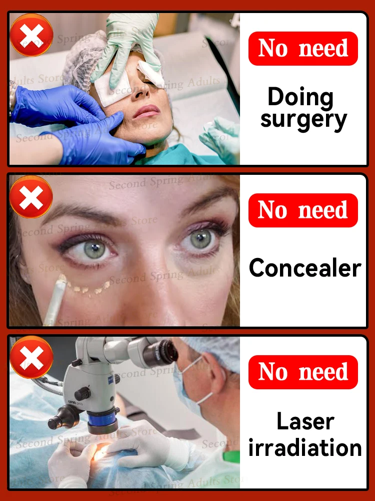 Eye Bag Solution Over 90% Buyer Says Eyes Bag Never Issue