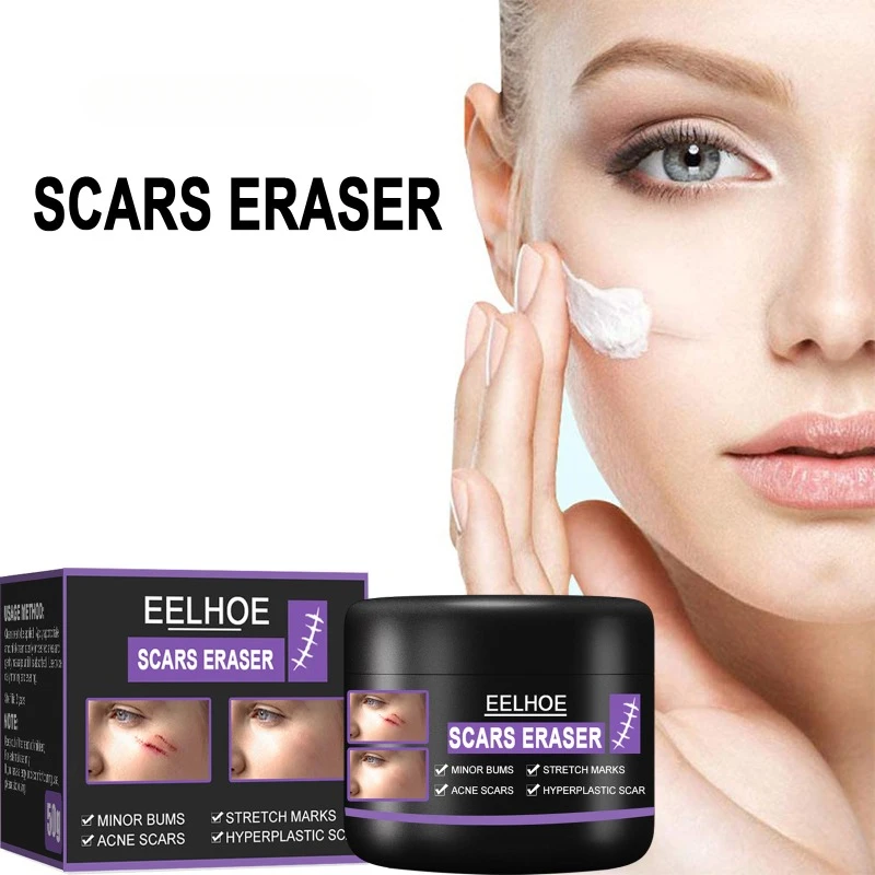 Scar Removal Cream Repair Stretch Marks Burn Surgical fade Acne old Scars Treatment Gel Whitening Beauty skin Health Care