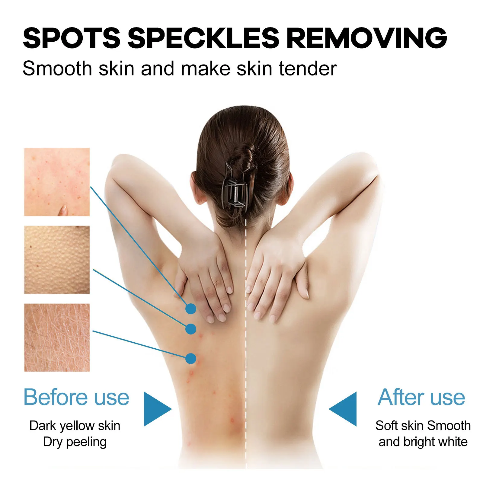 Aufhellende Körperlotion, entfernt Melanin, hellt raue, gelbe, trockene Haut auf, macht sie glatt, befeuchtet dunkle Flecken und erhellt die Arme._voghion.com