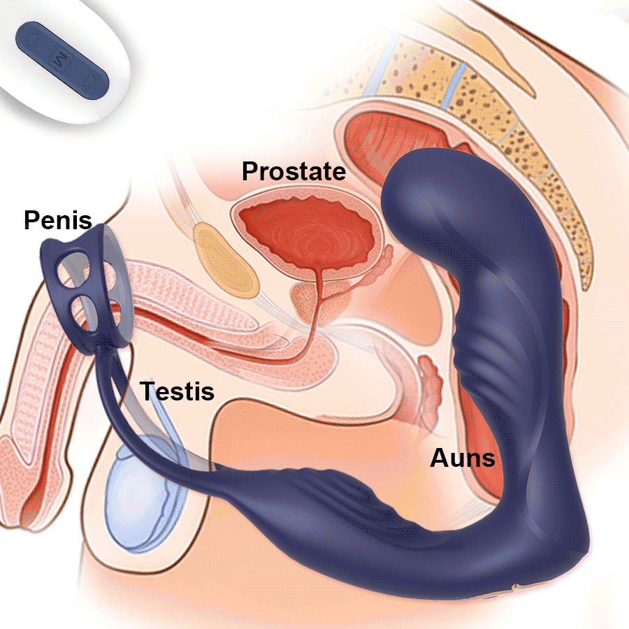 Anal Toys Male Prostate Massage Remote Dual Motor Anal Vibrator Delay  Ejaculation Cock Ring Testis Stimulate Anus Butt Adult Sex Toys 220922 From  Qiyue10, $14.53 | DHgate.Com