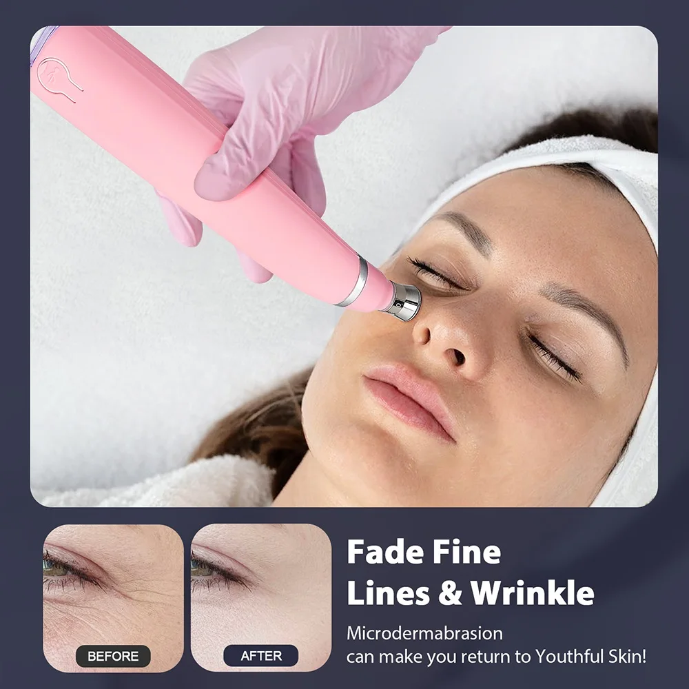 Portable Diamond Microdermabrasion Machine Facial Peeling Device Exfoliation Vacuum Blackhead Remover With 4 Diamond Peeling Tip 5