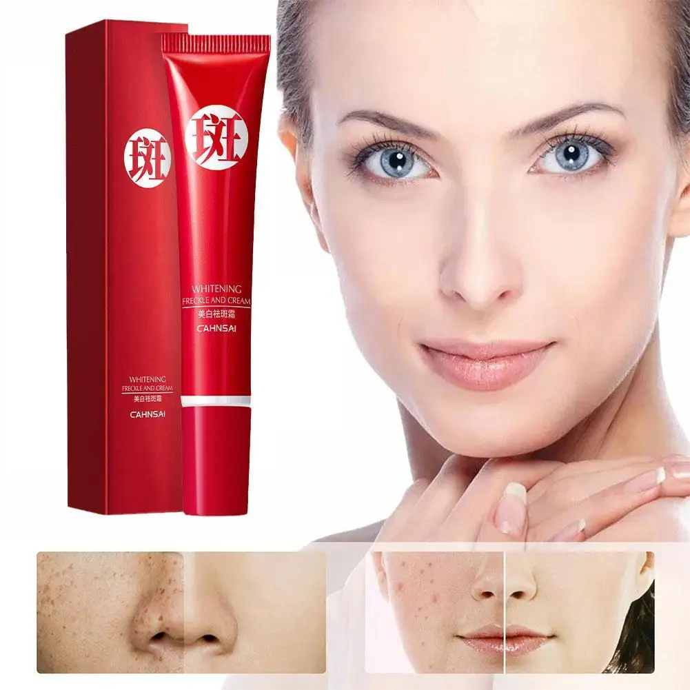 

Nicotinamide Whitening Freckle Cream Remove Melasma Dark Spots Lightening Moisturizing Nourishing Rejuvenation Skin Care