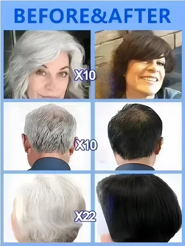 White To Black Gray White Hair Serum Natural Color Repair Nourishessence Anti-gray Care For Men Women