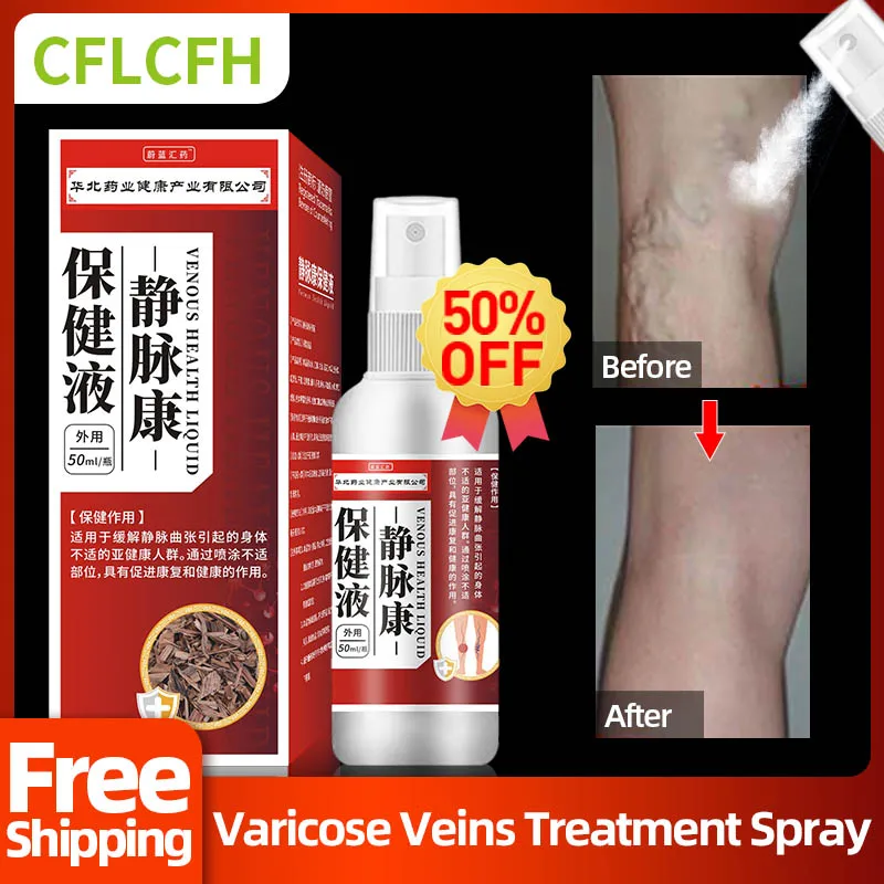 

Varicose Veins Relief Spray Spider Legs Vasculitis Phlebitis Removal Varicocele Varicosity Vein Foot Treatment Medicine 50ml