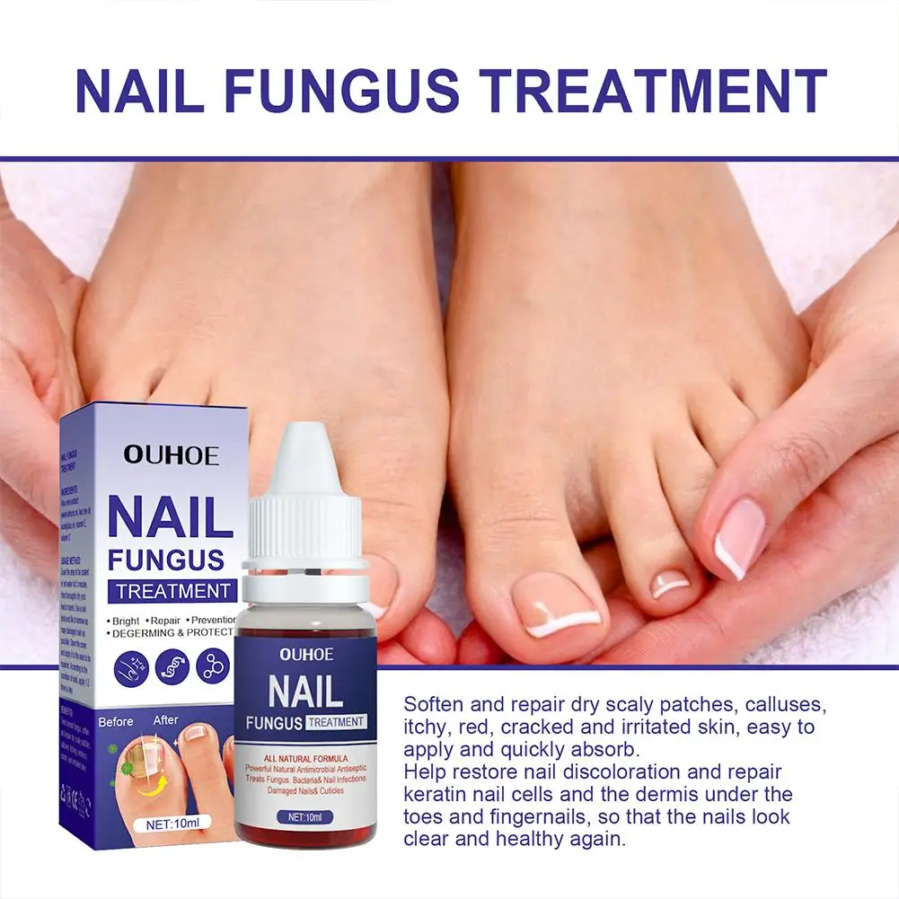 5PCS Nail Fungal Treatment Feet Care Essence Anti Infection Paronychia Onychomycosis Nail Repair Toe Fungus Serum Fungal Removal