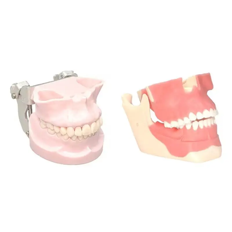 

1pcs Dental Student Learning Model Customized Anchorage Nail Training Teeth Model Removable Teeth