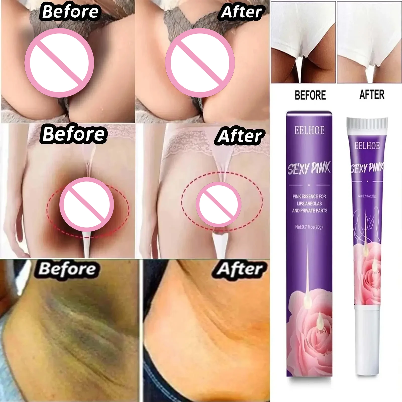 Whitening Lotion Whitening Cream For Private Parts Arm Knees Lip