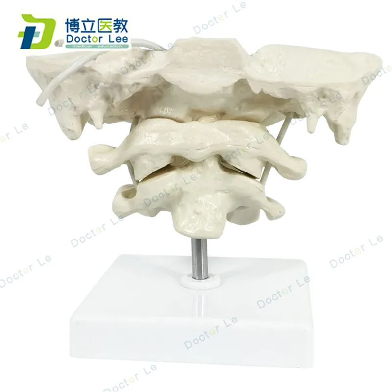 Enlarge the occipital, axial and atlas wiggly skeleton models for medical science learning