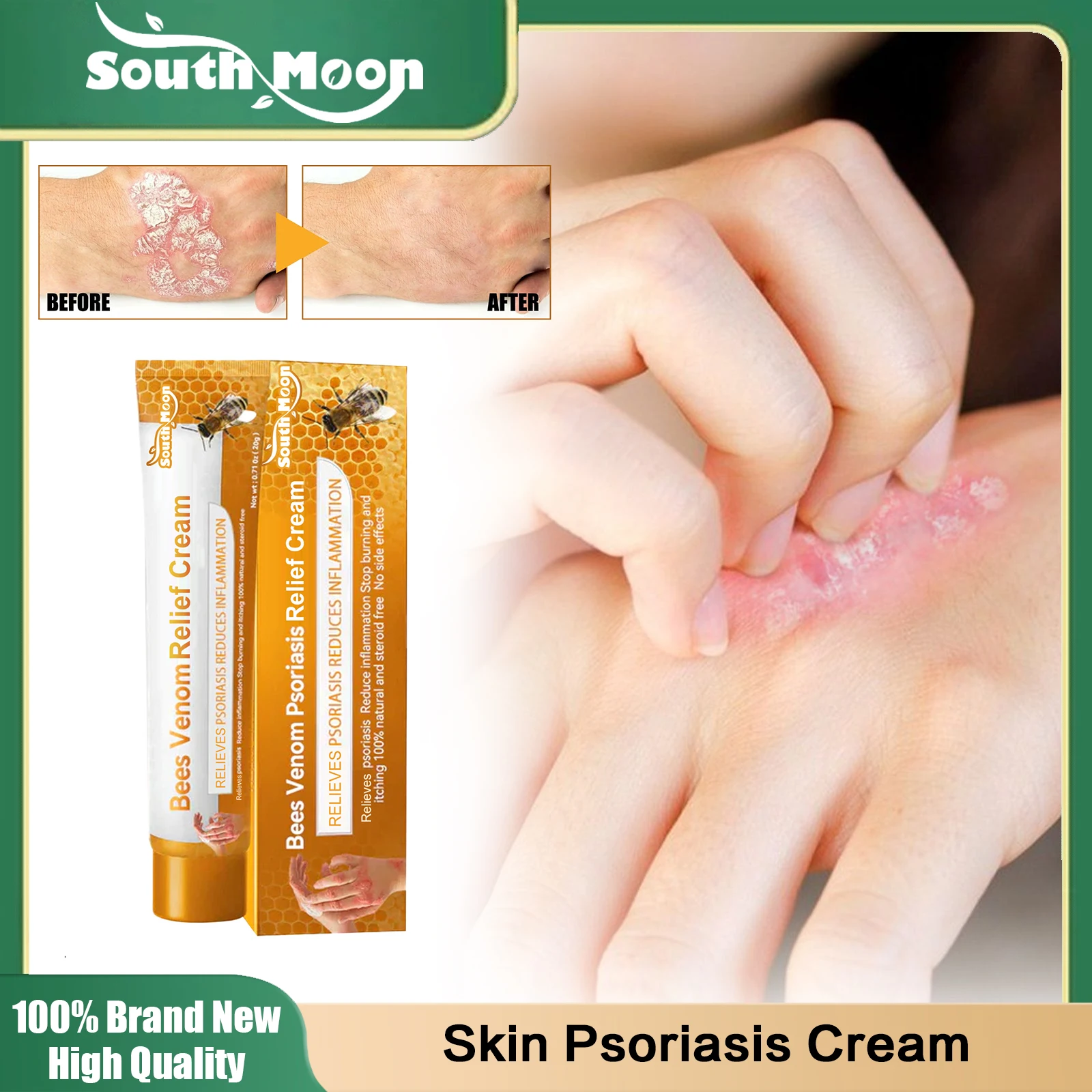 

Skin Psoriasis Cream Anti Itching Relieve Rash Urticaria Skin Inhibit Dermatitis Fungus Antibacterial Eczema Treatment Ointment