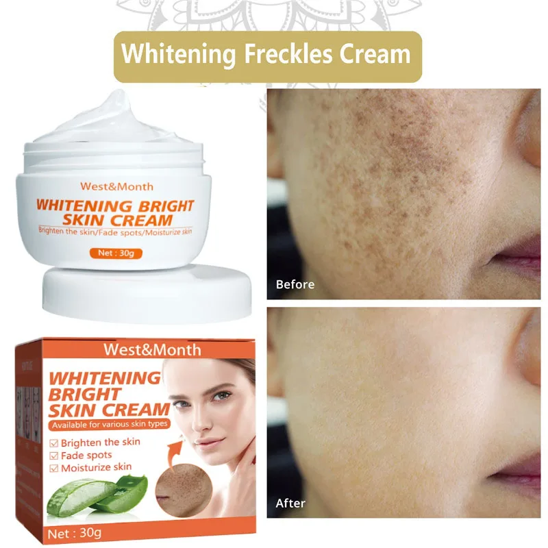 Whitening Freckle Cream Remove Melasma Dark Spots Improve Pigmentation