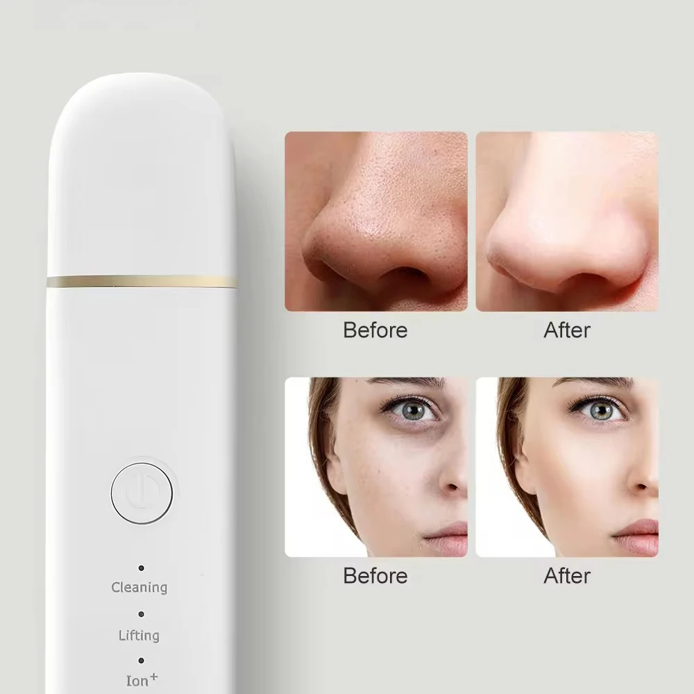 Skin Scrubber Face Spatula Pore Cleaner Blackhead Remover Tools 4 Modes