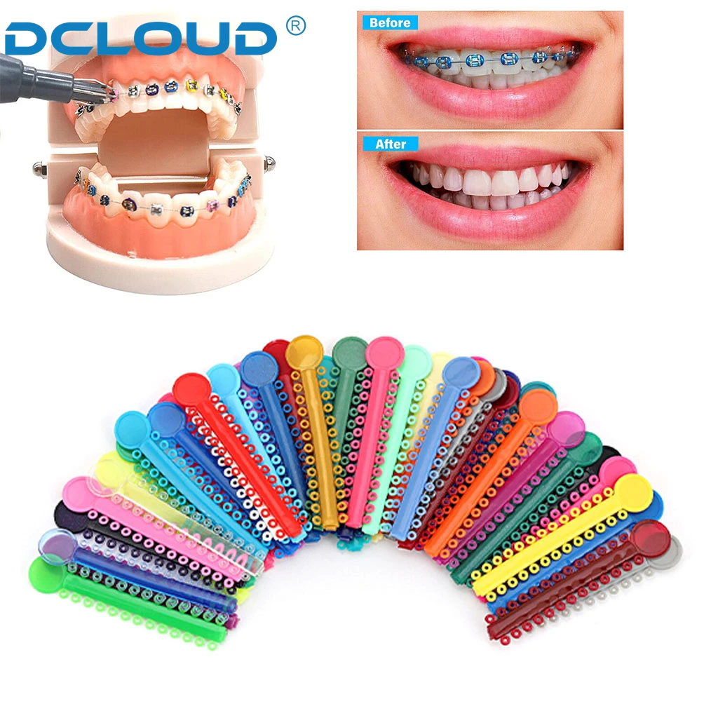 Рисунок 3 - = 40 палочек, стоматологическая ортодонтика