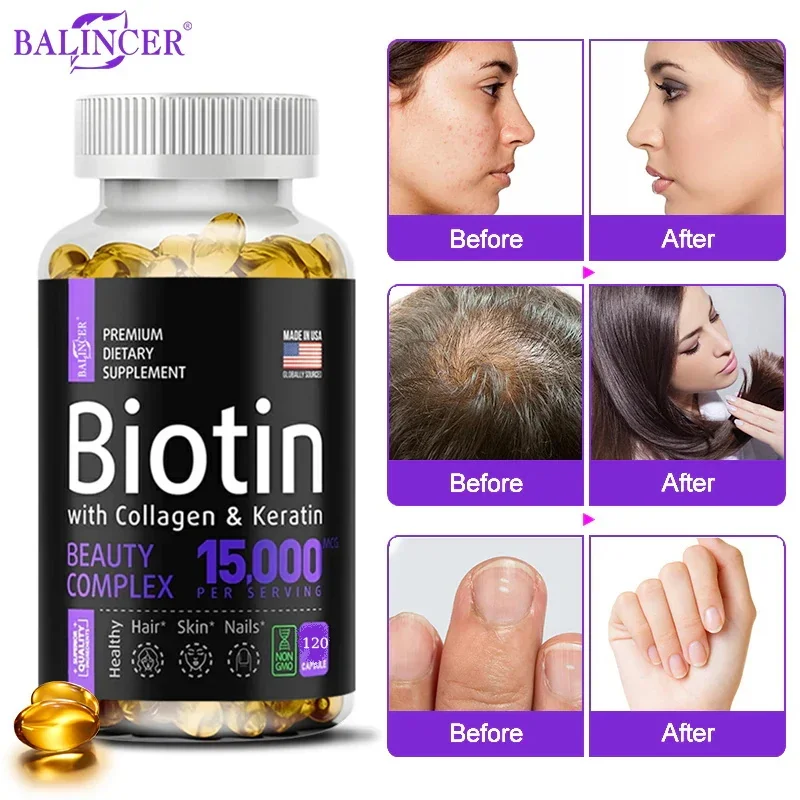 

Balincer Collagen Biotin Capsules, promote hair growth, strengthen brittle nails, beautiful skin, support joints and bones