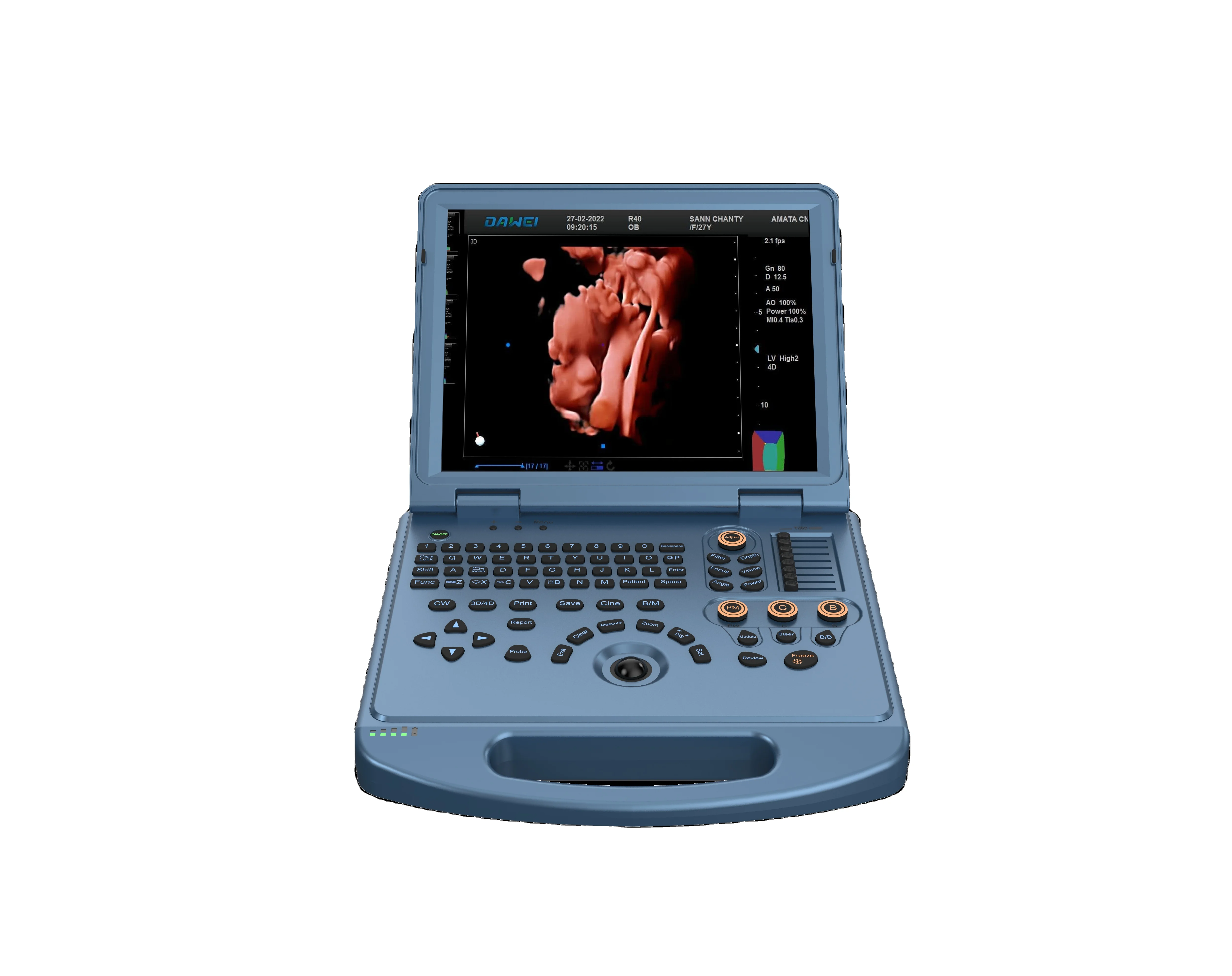 Ноутбук 4D D LIVE color doppler