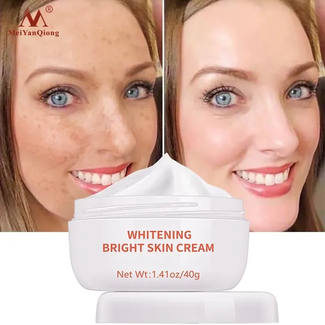 Whitening Face Cream Moisturizing Freckle Cream Remove Melasma Inhibit Dark Spots Pigment Melanin Anti Wrinkle Beauty Health 4