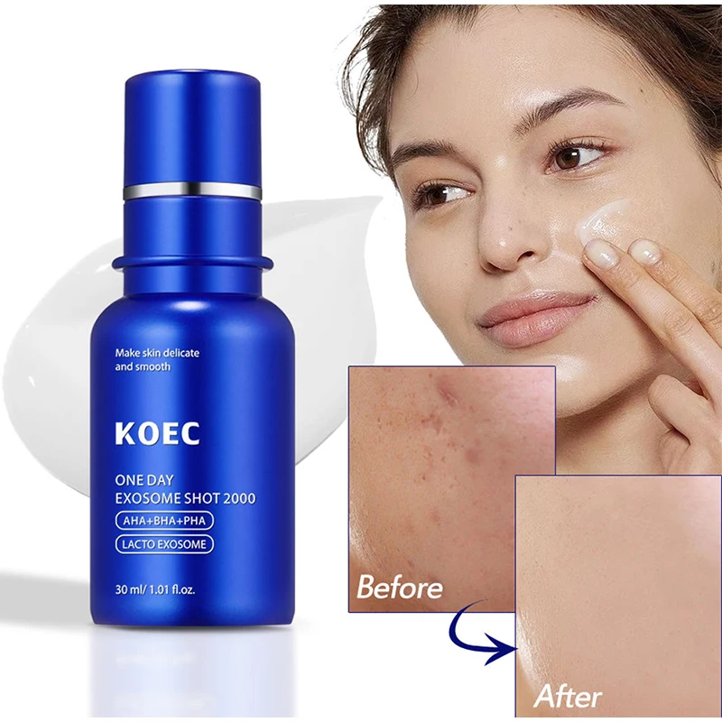 Koec Brand Collagen Toner Pore Cleaning Foam Cleanse Microneedle Essence Jelly Cream Rose Peptide Essence Korea Skincare Product facial cleanser