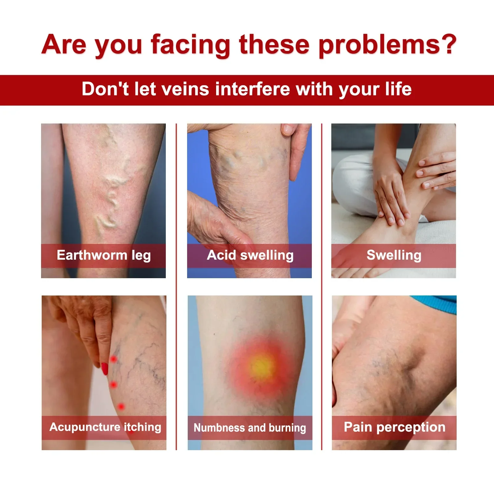 Varicose Veins Relief Cream Vasculitis Phlebitis Spider Pain Relief Ointment Medical Plaster Varicose Veins Treatment Body Cream