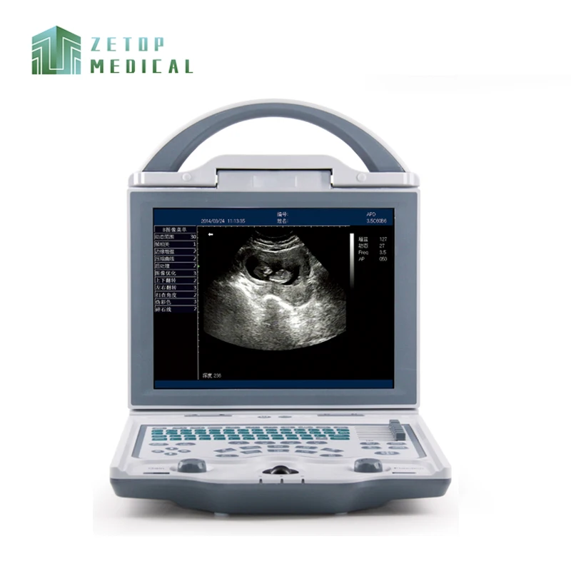 

Portable B/W Ultrasound Machine Digital Ultrasound Diagnostic Imaging System