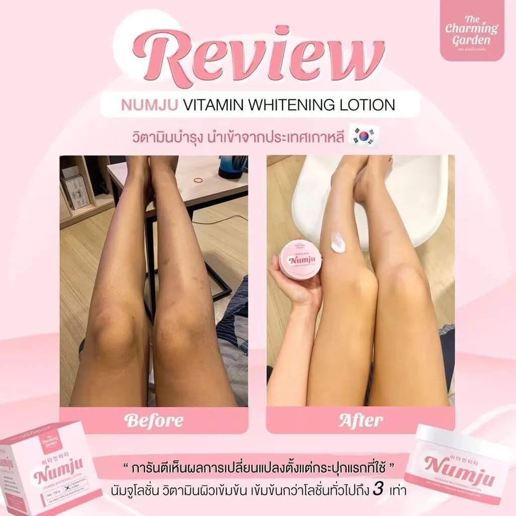 Numju-loci&oacute;n blanqueadora con vitamina, Reduce la oscuridad, axila, codos, rodillas, gl&uacute;teos, estr&iacute;as, piel blanca suave, 100 g