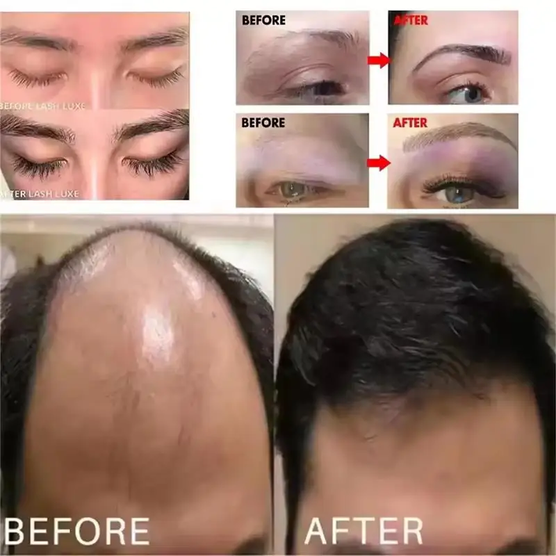 Eyebrows Growth Liquid Hair Fast Longer Fuller Thicker Usma Grass Serum Hair Loss Treatment Product Prevent Baldness Makeup New