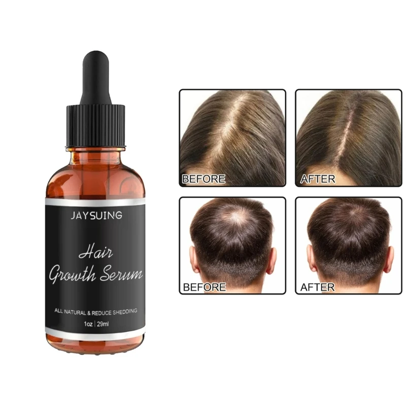 

Hair Care Essential Oil Rapid Growth Anti-hair Loss Treatments Hair Scalp Prevent Thinning Repair Damaged Hair E74C