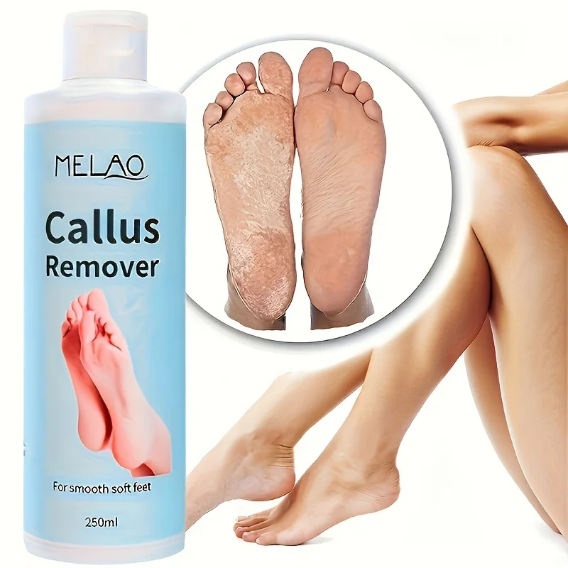 CALLUS REMOVER For Calluses Dry Hard Cracked Feet Ankle Heel