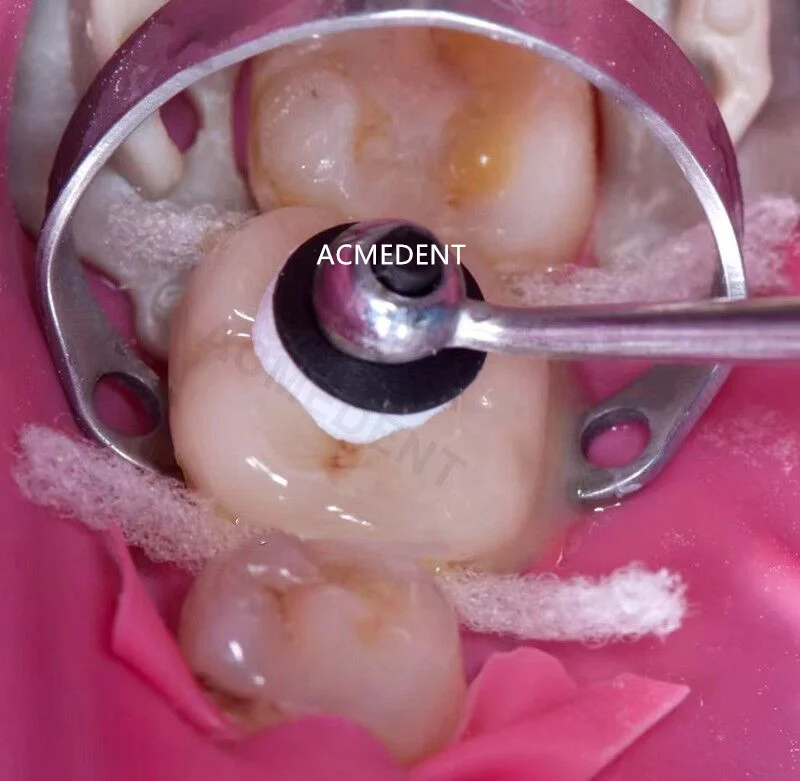 Рисунок 5 - Набор стоматологических композитных