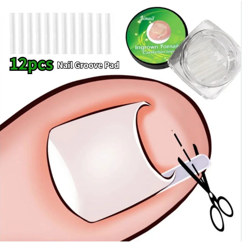 

12pcs Ingrown Toenail Correction Tool Ingrown Toe Nail Treatment Elastic Patch Sticker Straightening Clip Brace Pedicure Tool