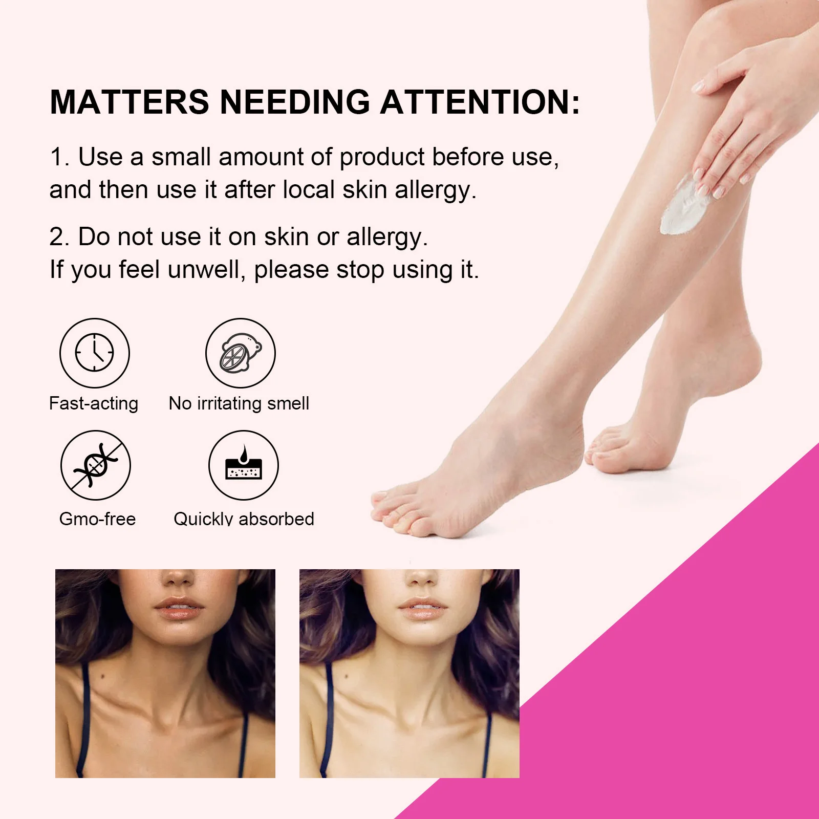 Crema sbiancante per il corpo Ascelle Ascelle Ginocchia Pelle scura Sbiancamento Dissolvenza Melanina Idratante Illumina la bellezza del corpo_voghion.com