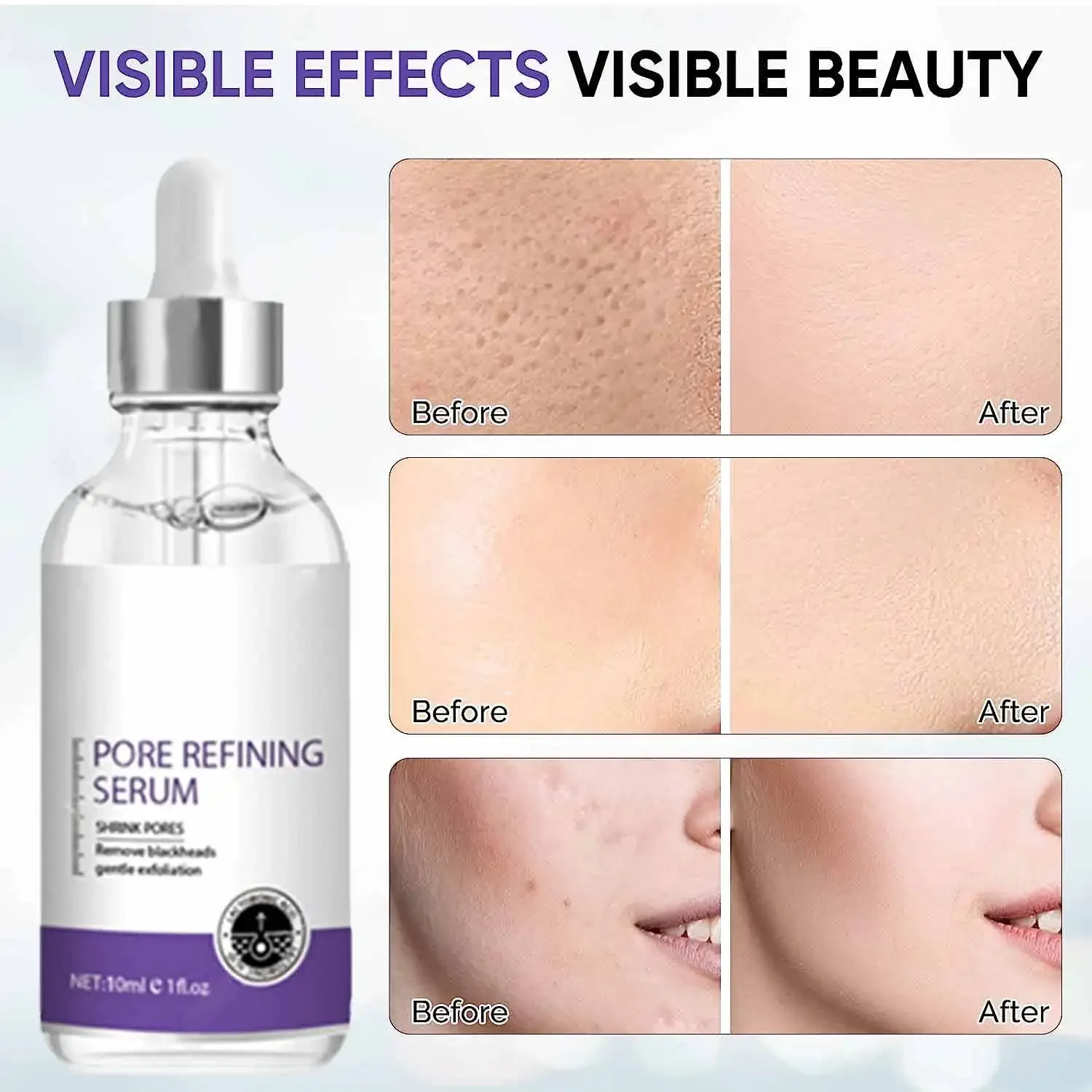 Pore Shrinking Serum Face Removing Large Pores Tightening Repairing Facial Pore Minimizing Essence Skin Care Beauty Firm skin https://bestebuys.com/shop/pore-shrinking-serum-face-removing-large-pores-tightening-repairing-facial-pore-minimizing-essence-skin-care-beauty-firm-skin/ BestEbuys - The Best Daily Online Deals