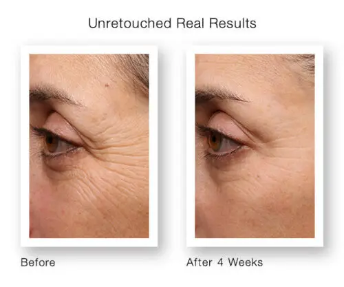 Pure Retinol Serum for Face Has Pure Retinol Cream Age Defying Wrinkles and Lines Acne Treatment Skin Care Products 2