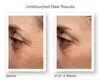 Pure Retinol Serum for Face Has Pure Retinol Cream Age Defying Wrinkles and Lines Acne Treatment Skin Care Products 2
