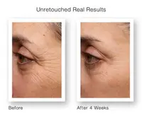 Pure Retinol Serum for Face Has Pure Retinol Cream Age Defying Wrinkles and Lines Acne Treatment Skin Care Products 2