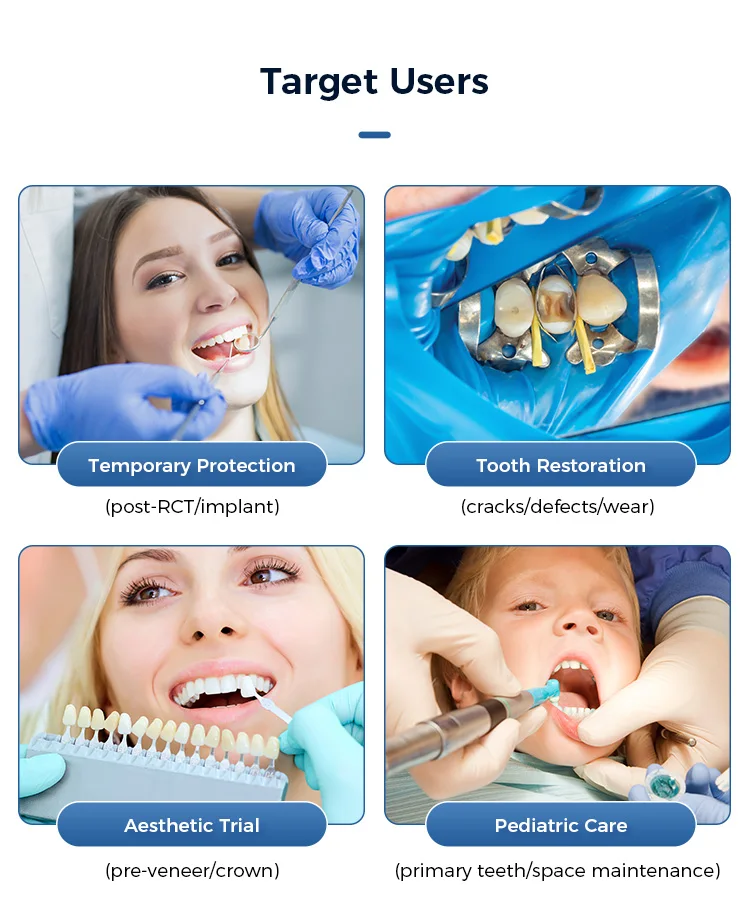 50 Stück Harz-Dentalprovisional Veneers A1/A2 Shade Ultradünne temporäre Kronen für obere vordere und vordere und backenzähne AZDENT – Detail 4