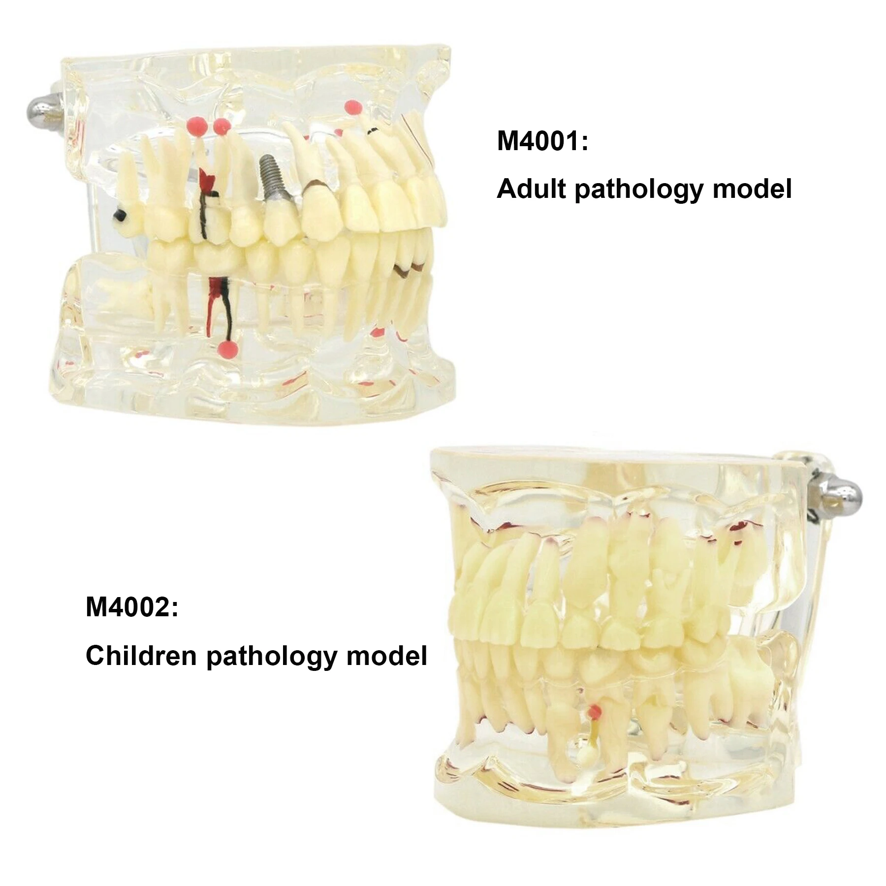 DentistryTeethModelImplantDiseaseDentistPatientEducationModelToothDemonstrationModels