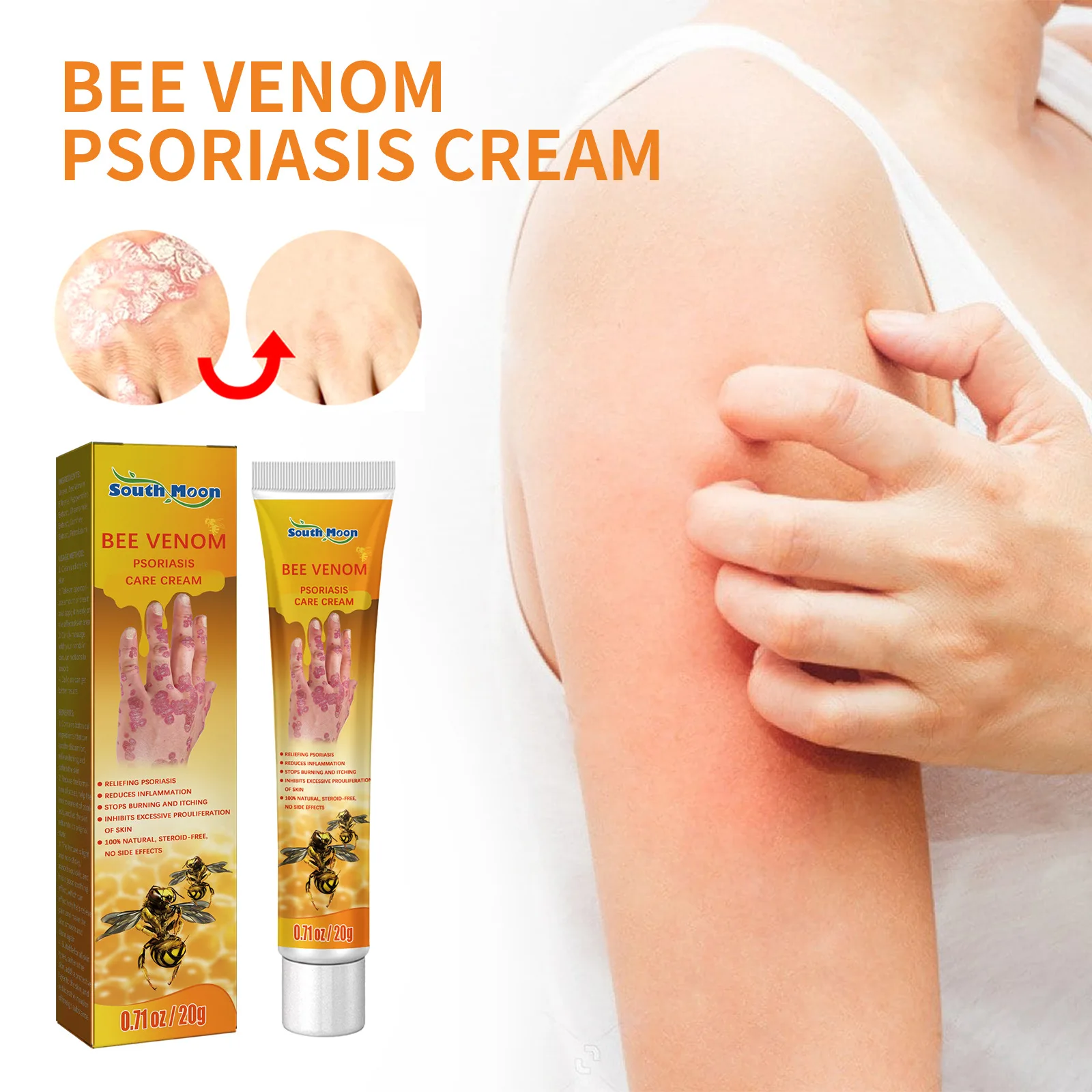 

20g Bee Venom Professional Treatment Gel Skin Repair Cream Repair Hand And Foot Moss Moisturize Relieve Itchy Skin Care