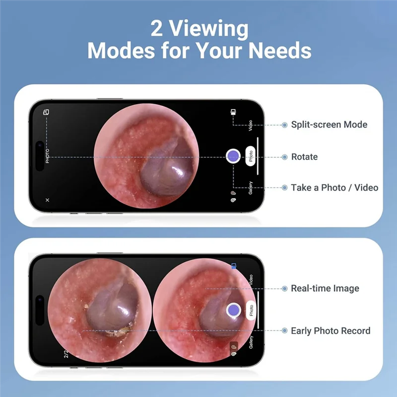 SUNRI-Digital Otoscope With Light, 1.85 In IPS Screen, 720P HD Video Ear Camera, Ear Wax Removal Tool 5