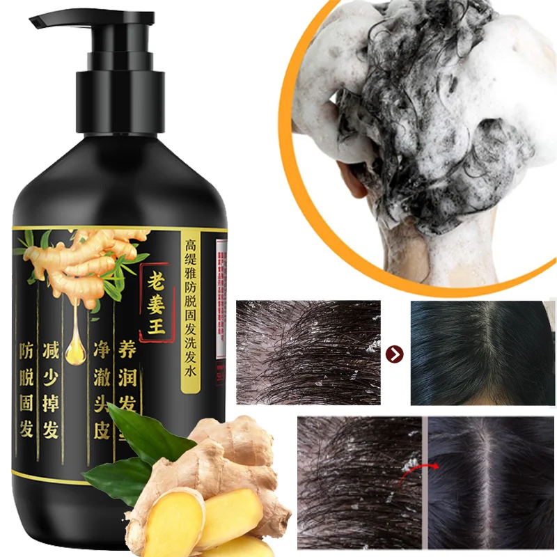 

Anti-hair Loss Shampoo Amino Acid Conditioner Ginger Old Ginger King Balance Oil Strongman Hair Anti-dandruff Shampoo Shampoo