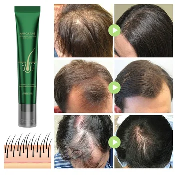 Soluzione nutrizionale per capelli allo zenzero naturale per la cura dei capelli, olio essenziale, per la protezione, previene la rottura, rafforza la radice dei capelli