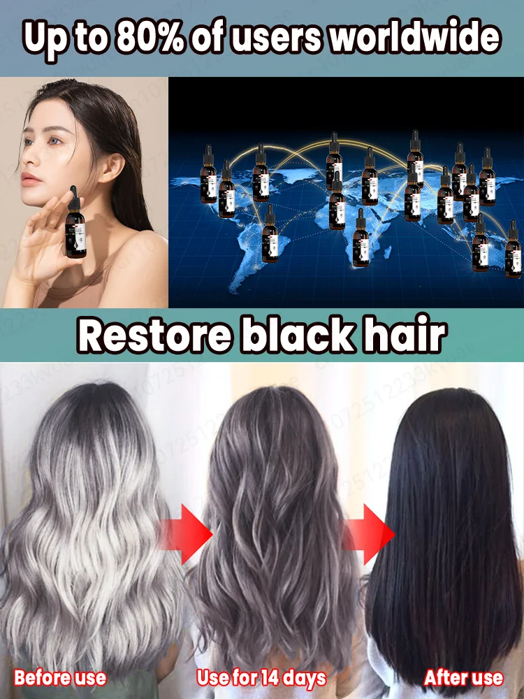 Hair Oil Hair Essence Oil Natural Anti-Gray Hair Serum 7-Day Dark Hair Restoration & 98% Gray Prevention-Root Repair with Botanical Extract