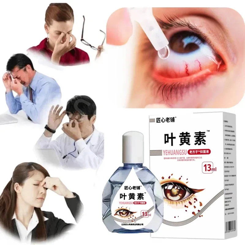 Lutein-Eye-Drops-Relieve-Eye-Fatigue-Dryness-Improve-Vision-Eye-Care ...