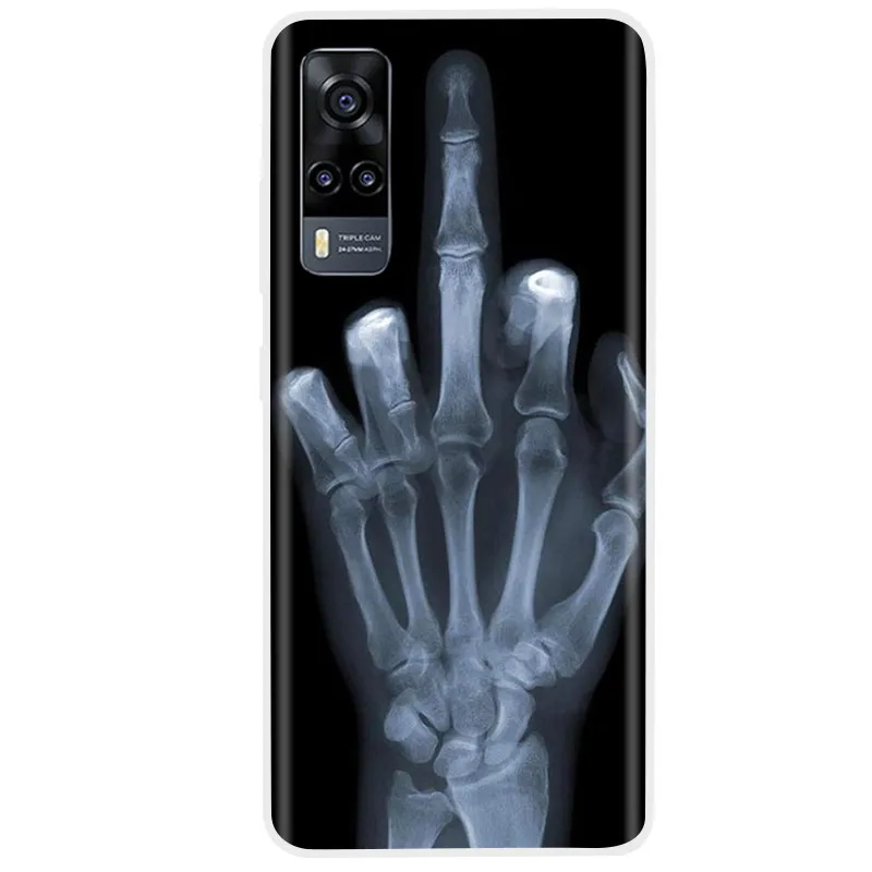 Phone Case For Vivo Y31 Case Vivo Y31 Cover Soft Tpu Silicone Phone Case For Y53S 4G V2036 Back Cover Coque Funda Bumper Etui phone case phone protector cover