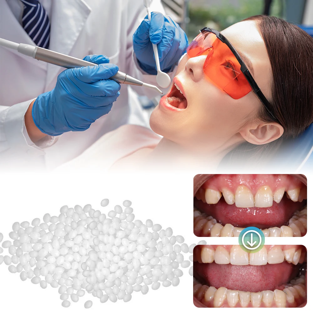 3pcs/Pack Included 30g Fitting Beads Can Be Used Instant Smile Teeth  Replacement Thermal Adhesive Fitting Beads for Fake Teeth - AliExpress
