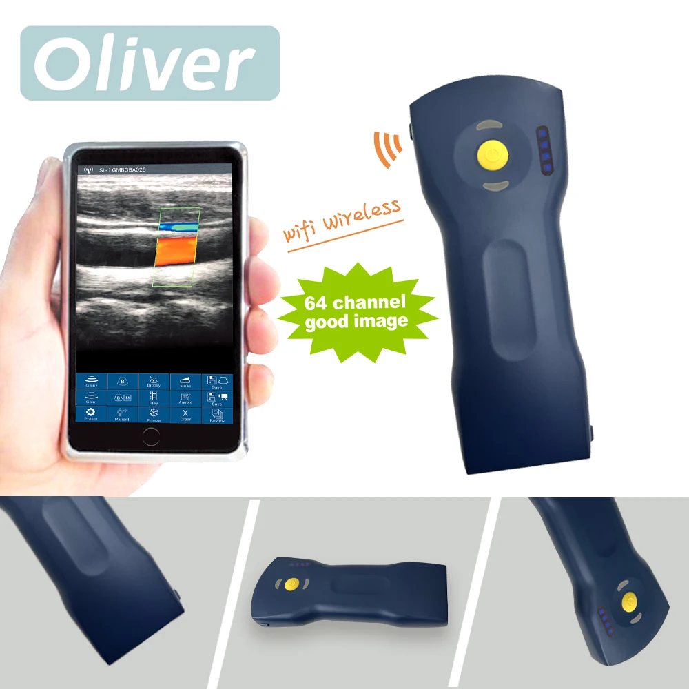 Sonda de ultrasonido inalámbrica de 256 elementos y 64 canales, escáner portátil con Wi-Fi, Doppler color, lineal y convexo 3 en 1