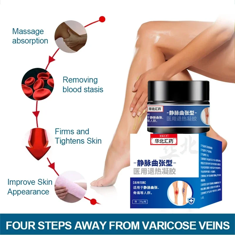 20g Varicose Veins Remover Cream Phlebitis Pain Relief Health Care Varicosity Angiitis Spider Treatments Herbal Medical Plaster