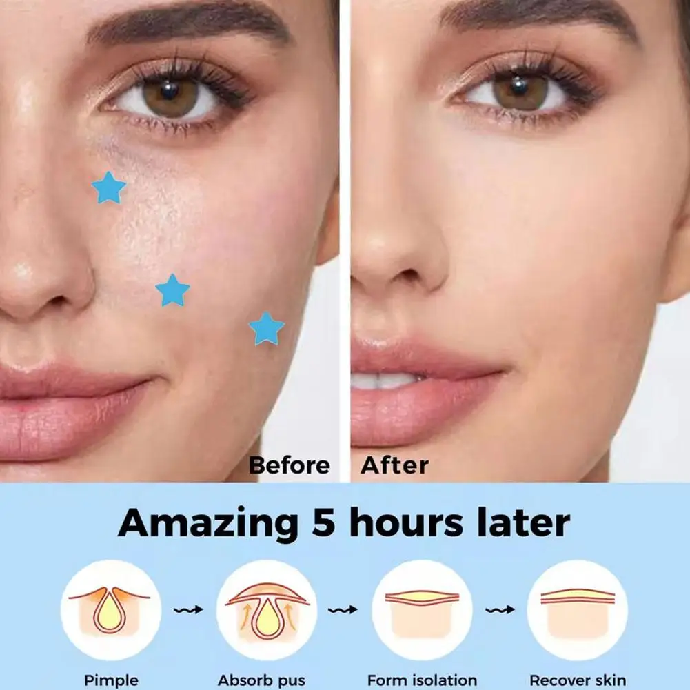 Enhanced Hydrocolloid Gentle Acne Absorption Pimple Patches - Superstar Collection