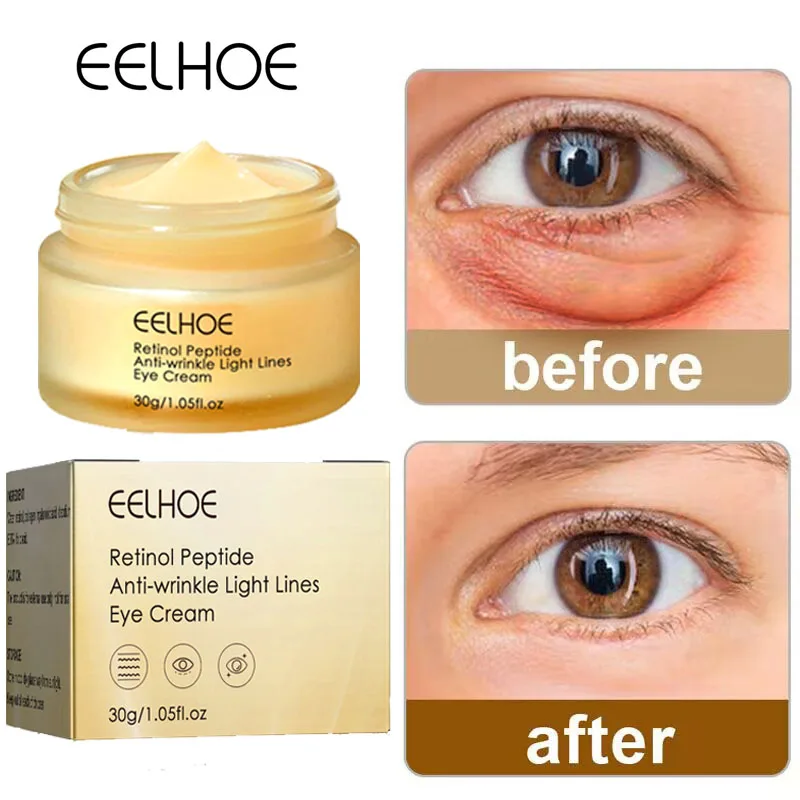 Retinol Anti-Wrinkle Eye Cream Remove Eye Bags Dark Circles Anti Aging Lifting Firming Whitening Moisturizing Skin Care Products images snail eye cream whitening moisturizing anti aging wrinkle remove dark circles snail cream