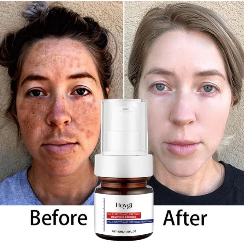 Vitamin C Facial Whitening Serum